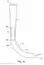 Fig. 08 - Luminous optical laryngoscope comprising built-in fluid-extraction device
