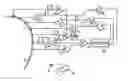 Fig. 01 - Detection and stimulus conditioning system for sleep apnea