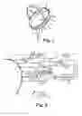 Fig. 02 - Detection and stimulus conditioning system for sleep apnea