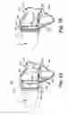Fig. 08 - Disposable tip cover for a tonometry apparatus