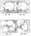 Fig. 12 - Systems and methods for virtual identification of polyps