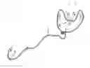 Fig. 01 - Detection appliance and method for observing sleep-related breathing disorders