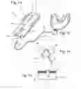 Fig. 02 - Detection appliance and method for observing sleep-related breathing disorders