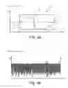Fig. 12 - Detection appliance and method for observing sleep-related breathing disorders