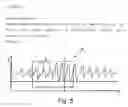 Fig. 15 - Detection appliance and method for observing sleep-related breathing disorders