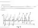 Fig. 16 - Detection appliance and method for observing sleep-related breathing disorders