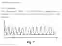 Fig. 17 - Detection appliance and method for observing sleep-related breathing disorders