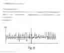 Fig. 18 - Detection appliance and method for observing sleep-related breathing disorders