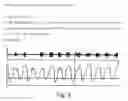 Fig. 19 - Detection appliance and method for observing sleep-related breathing disorders