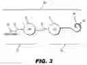 Fig. 04 - Methods and systems for denoising a neural recording signal