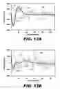 Fig. 14 - Methods and systems for denoising a neural recording signal