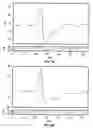 Fig. 04 - Method of using dermatomal somatosensory evoked potentials in real-time for surgical and clinical management