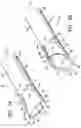Fig. 07 - Tissue cutting member for a biopsy device