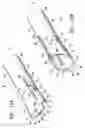 Fig. 13 - Tissue cutting member for a biopsy device