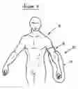 Fig. 08 - Lim protection system