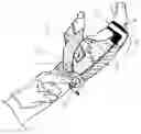 Fig. 01 - Low-profile, radial nerve splint with interchangeable resilient digit extensor elements and supination adjustment means