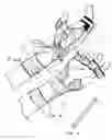 Fig. 03 - Low-profile, radial nerve splint with interchangeable resilient digit extensor elements and supination adjustment means