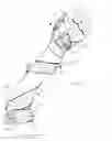 Fig. 08 - Low-profile, radial nerve splint with interchangeable resilient digit extensor elements and supination adjustment means