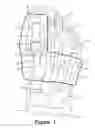 Fig. 02 - Functional toe brace