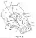Fig. 03 - Functional toe brace