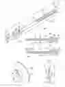Fig. 03 - Lacrimal drainage bypass device and method