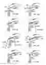 Fig. 08 - Lacrimal drainage bypass device and method