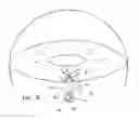 Fig. 03 - Glaucoma treatment device and method