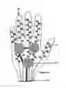 Fig. 03 - Device and method for delivery of therapeutic agents to the dermis and epidermis