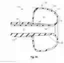 Fig. 15 - Feeding device including balloon tip and method of manufacture