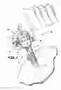 Fig. 02 - Trocar and cannula assembly having conical valve and related methods