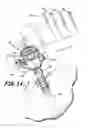 Fig. 08 - Trocar and cannula assembly having conical valve and related methods