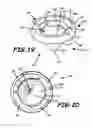 Fig. 12 - Trocar and cannula assembly having conical valve and related methods