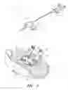 Fig. 03 - Medical article anchoring system