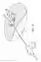 Fig. 05 - Medical article anchoring system
