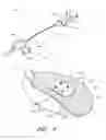 Fig. 08 - Medical article anchoring system