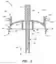 Fig. 04 - Infusion set