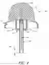 Fig. 05 - Infusion set