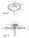 Fig. 06 - Infusion set