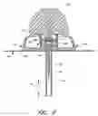 Fig. 09 - Infusion set