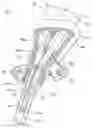Fig. 01 - Multi-lumen catheter with attachable hub
