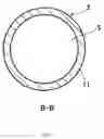 Fig. 06 - Thrombus suction catheter