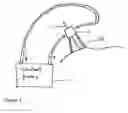 Fig. 03 - Cannula cooling and positioning device