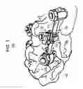 Fig. 02 - Pedicle screw, cervical screw and rod
