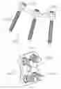 Fig. 08 - Osteoconductive spinal fixation system