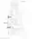 Fig. 03 - Revisable anterior cervical plating system