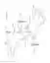 Fig. 18 - Revisable anterior cervical plating system