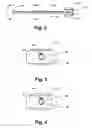 Fig. 03 - Method and apparatus for implanting a hydrogel prosthesis for a nucleus pulposus