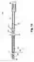 Fig. 07 - Method and apparatus for implanting a hydrogel prosthesis for a nucleus pulposus