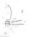 Fig. 02 - Electromagnetically guided spinal rod system and related methods
