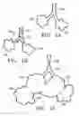 Fig. 02 - Methods for treating chronic obstructive pulmonary disease